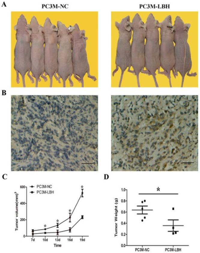 J Cancer Image