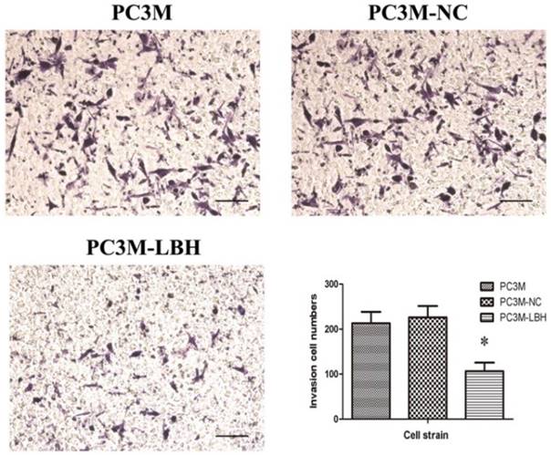 J Cancer Image