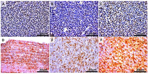 J Cancer Image