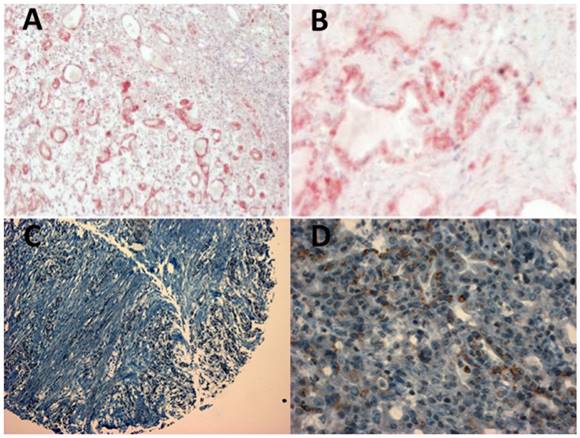 J Cancer Image