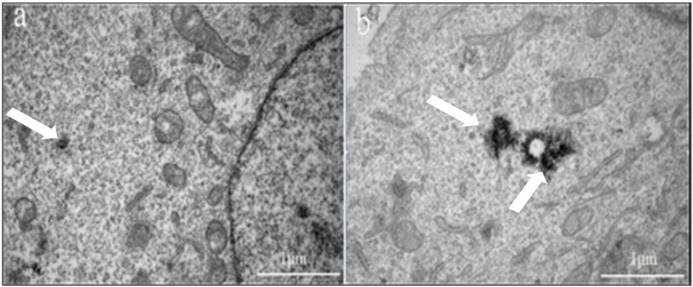 J Cancer Image