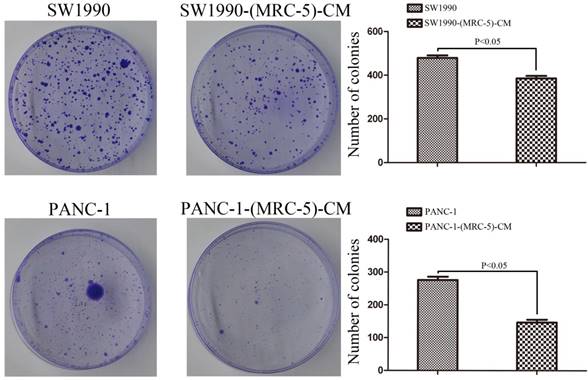 J Cancer Image