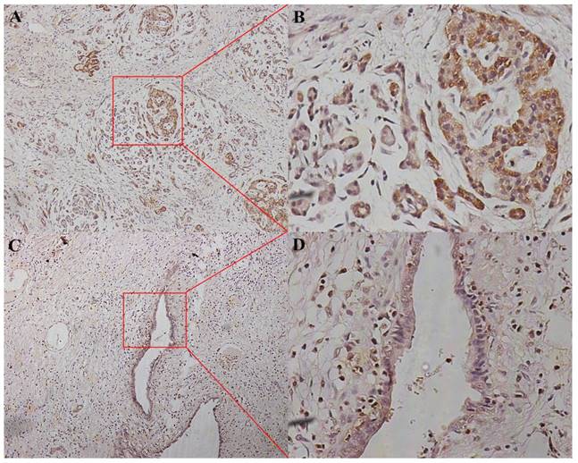 J Cancer Image