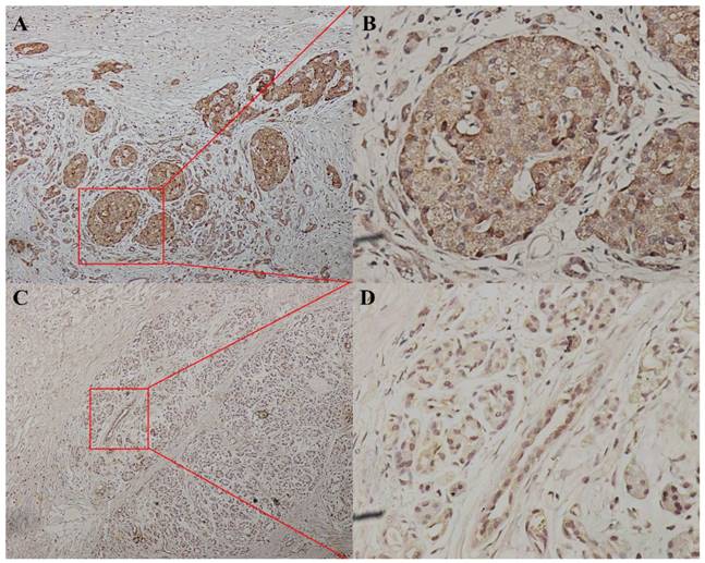 J Cancer Image