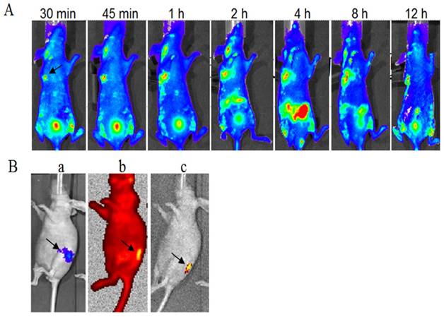 J Cancer Image