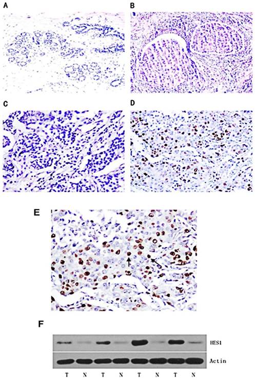 J Cancer Image