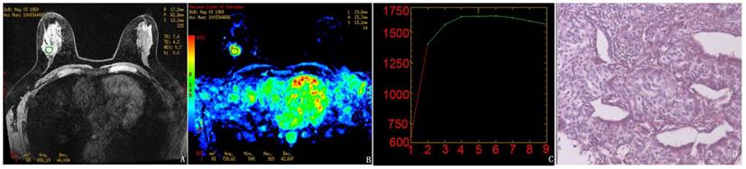 J Cancer Image