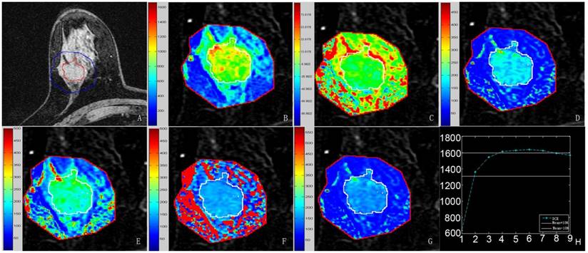 J Cancer Image