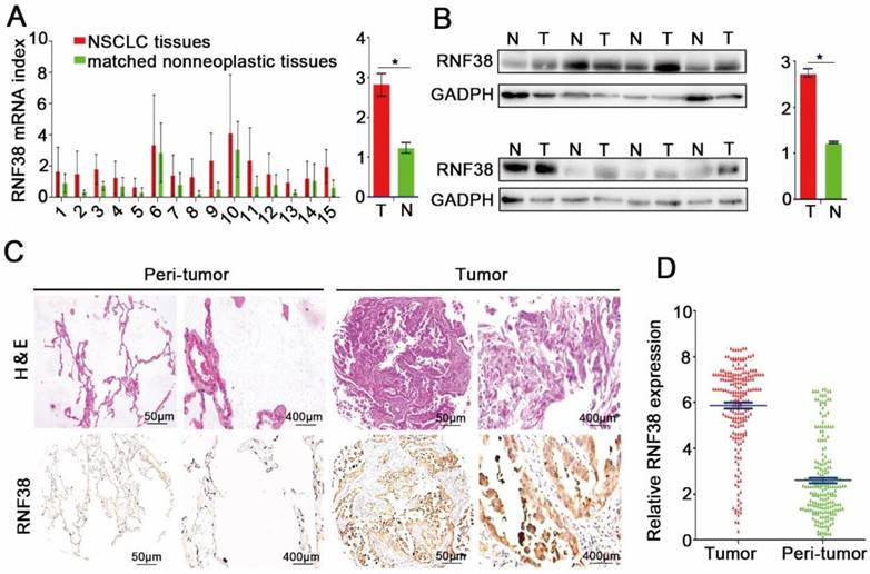 J Cancer Image