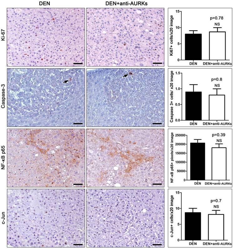 J Cancer Image