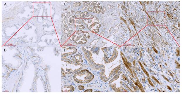 J Cancer Image