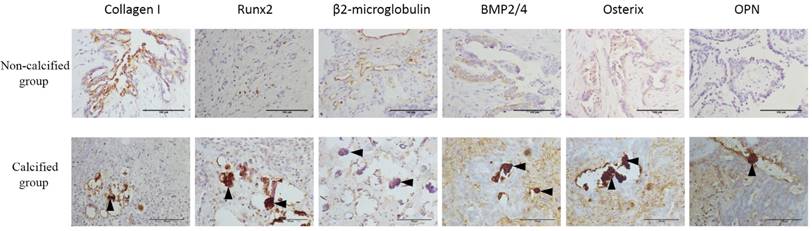 J Cancer Image