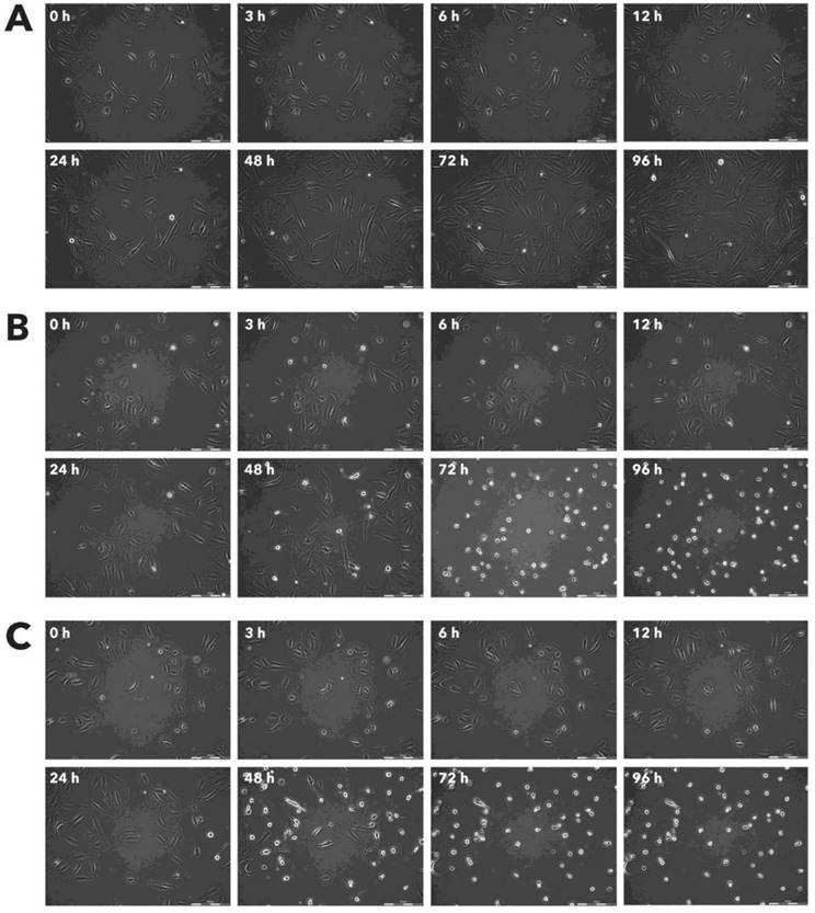 J Cancer Image