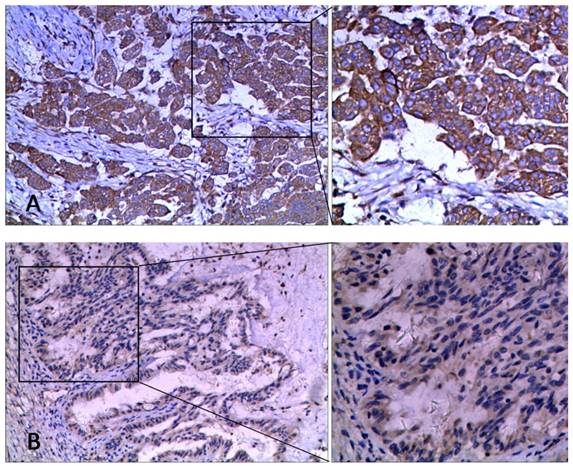 J Cancer Image