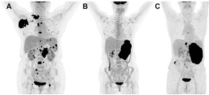 J Cancer Image