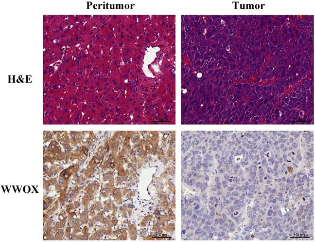 J Cancer Image