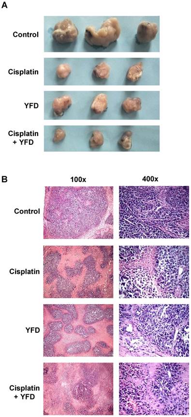 J Cancer Image