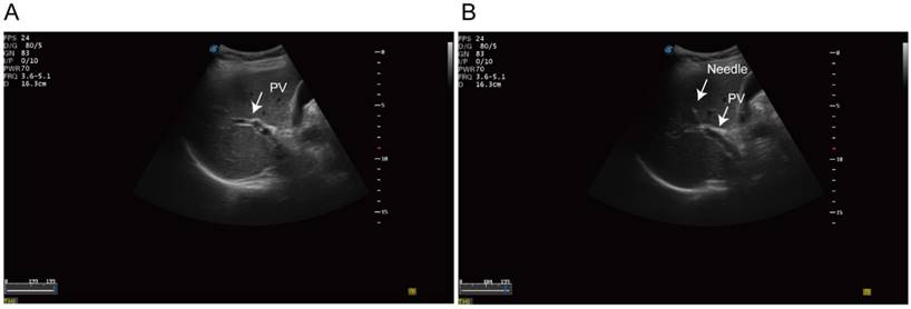 J Cancer Image