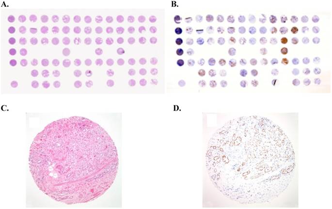 J Cancer Image