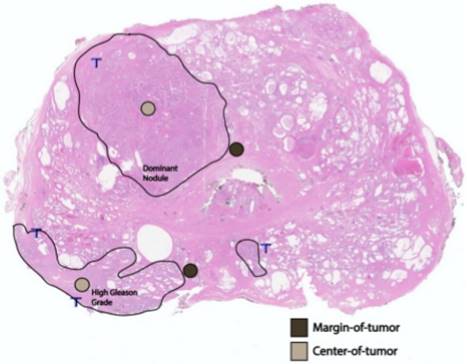 J Cancer Image