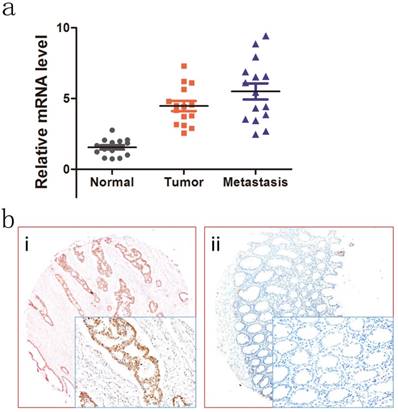 J Cancer Image