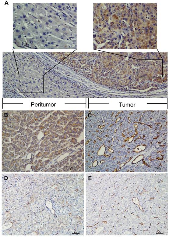 J Cancer Image