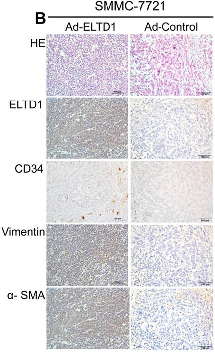 J Cancer Image