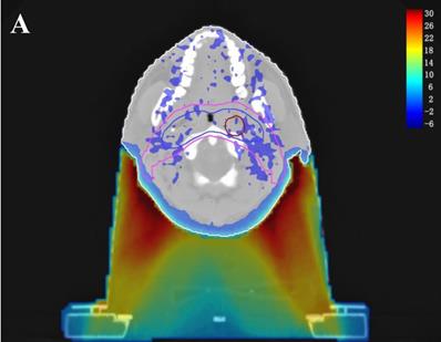 J Cancer Image