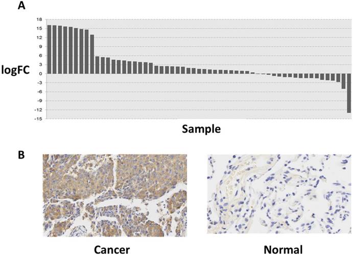 J Cancer Image