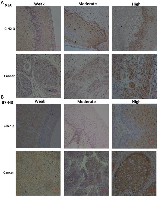 J Cancer Image