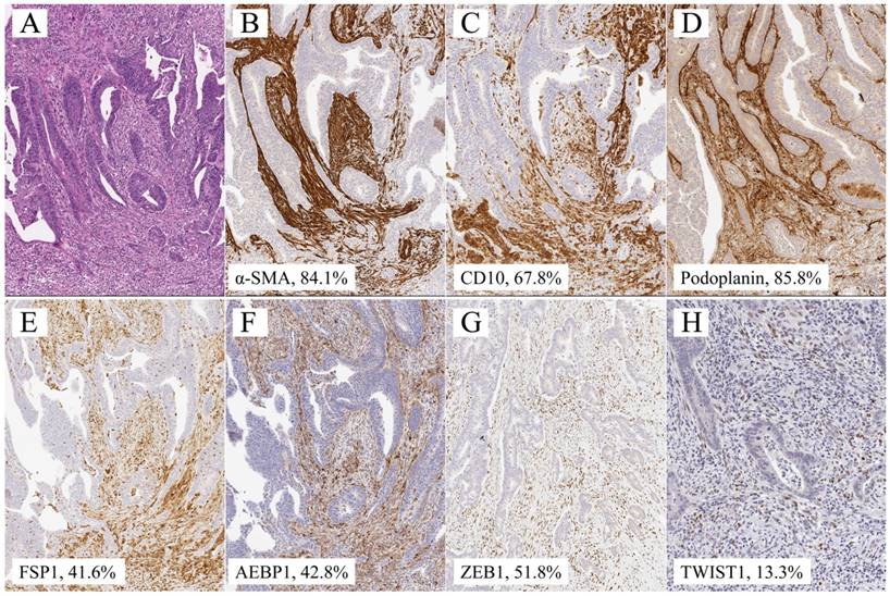 J Cancer Image