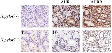 J Cancer Image