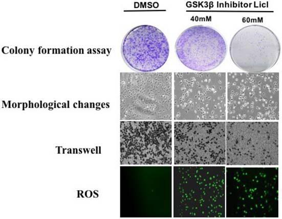 J Cancer Image