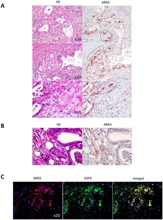 J Cancer Image