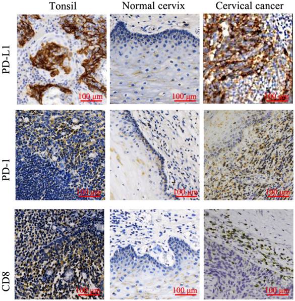 J Cancer Image