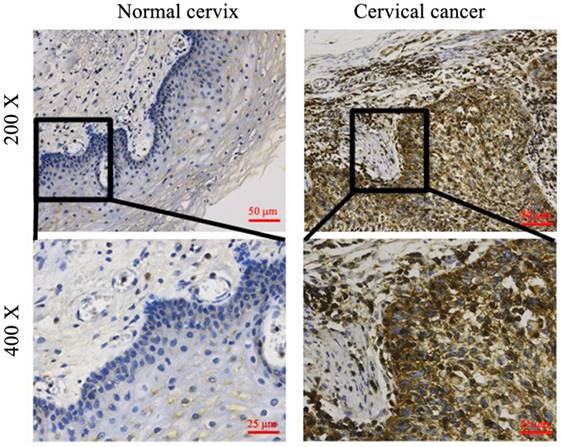 J Cancer Image