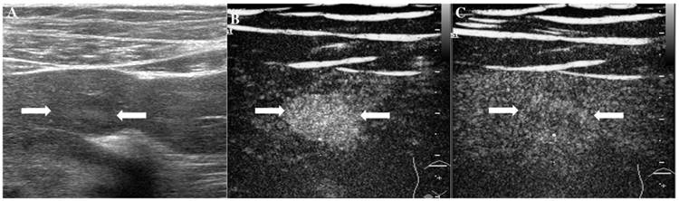 J Cancer Image