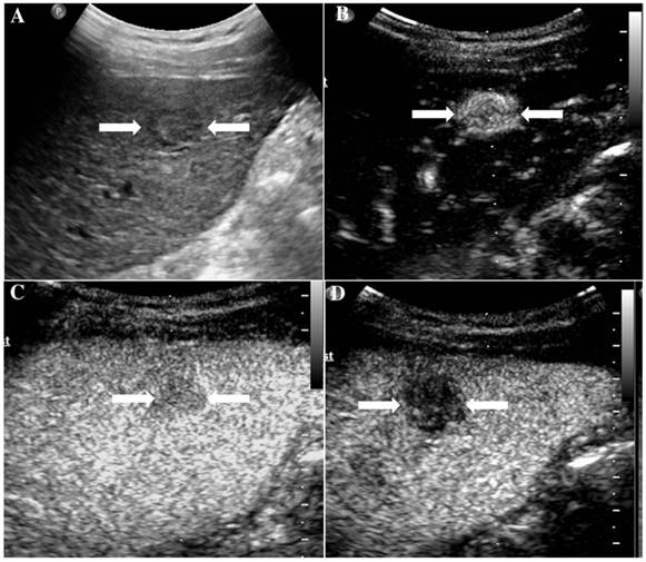 J Cancer Image