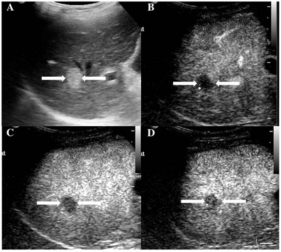 J Cancer Image