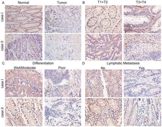 J Cancer Image