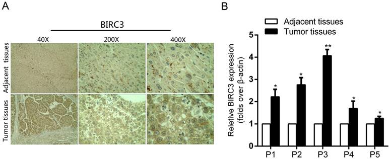 J Cancer Image