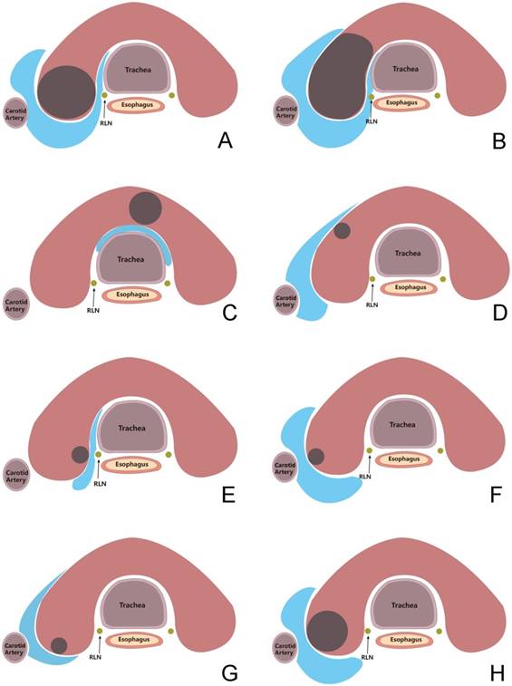 J Cancer Image