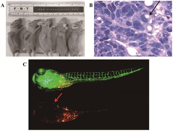 J Cancer Image