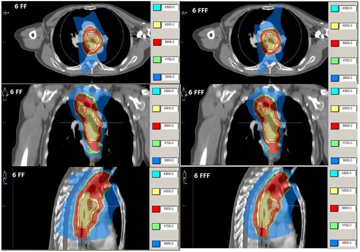 J Cancer Image