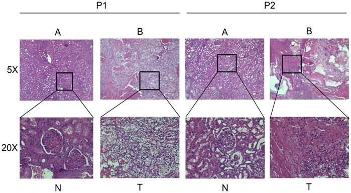 J Cancer Image