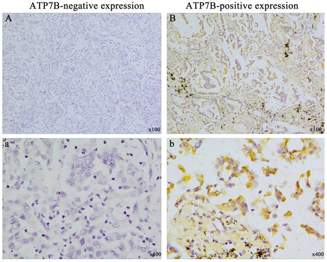 J Cancer Image