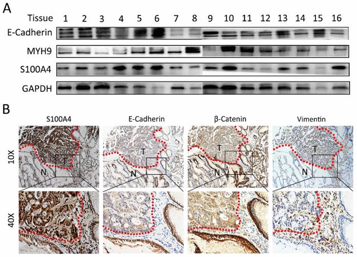 J Cancer Image