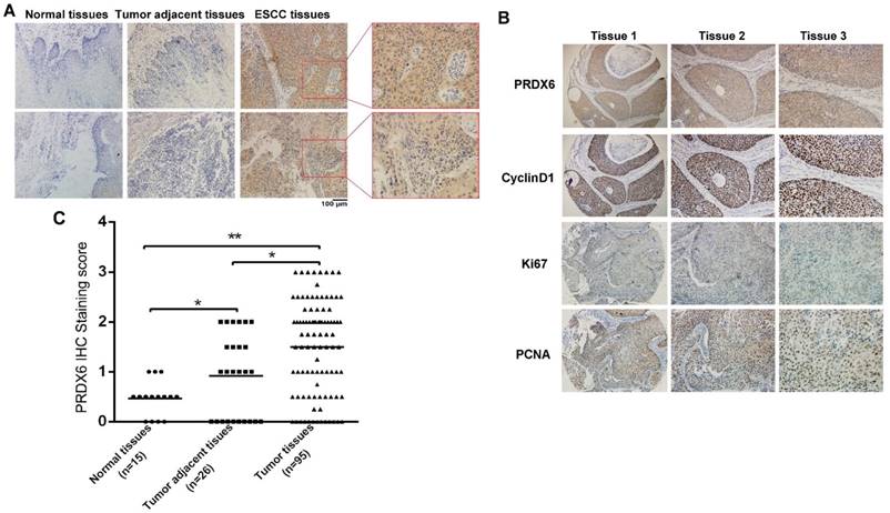 J Cancer Image