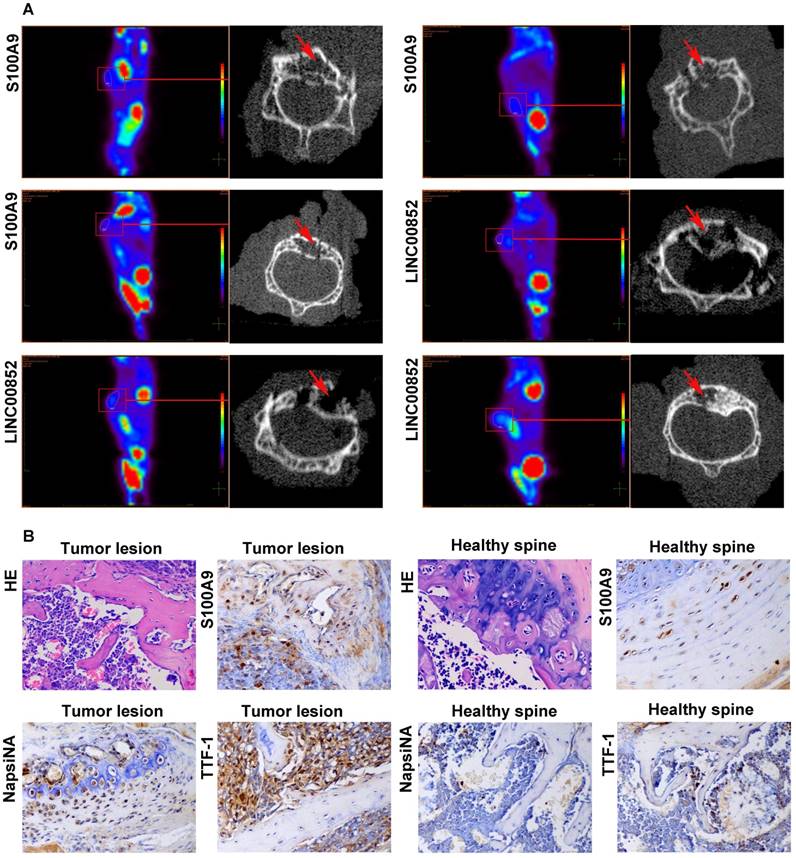 J Cancer Image