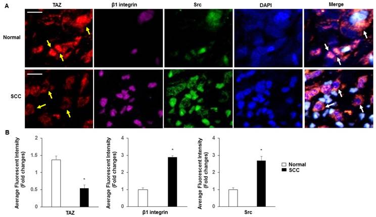 J Cancer Image